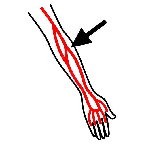 artery, arteries