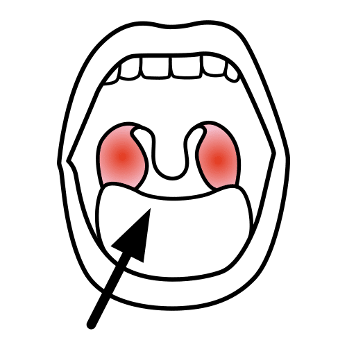 tonsils