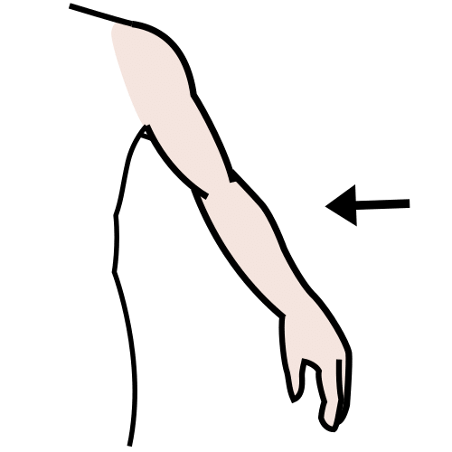 arm