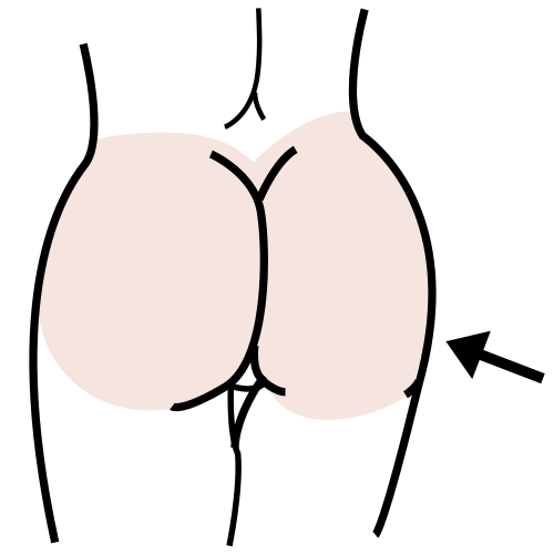 buttock
