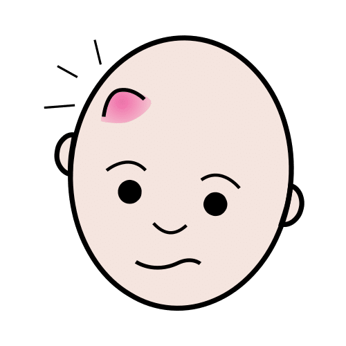 bump on the head