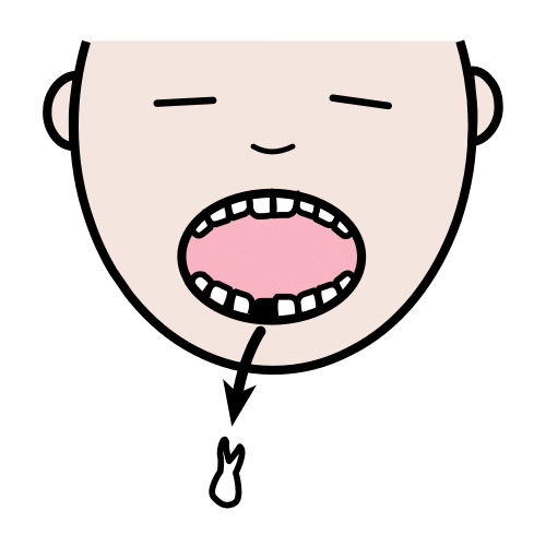 tooth fall out