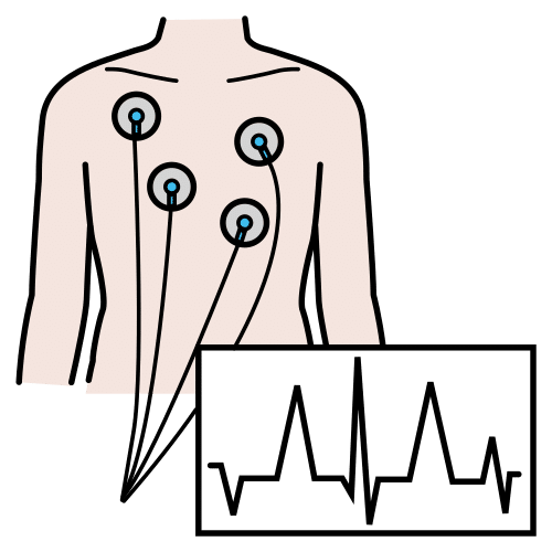 electrocardiogram