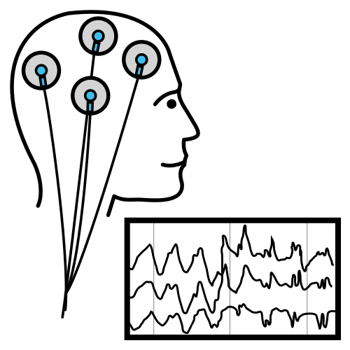 electroencephalogram