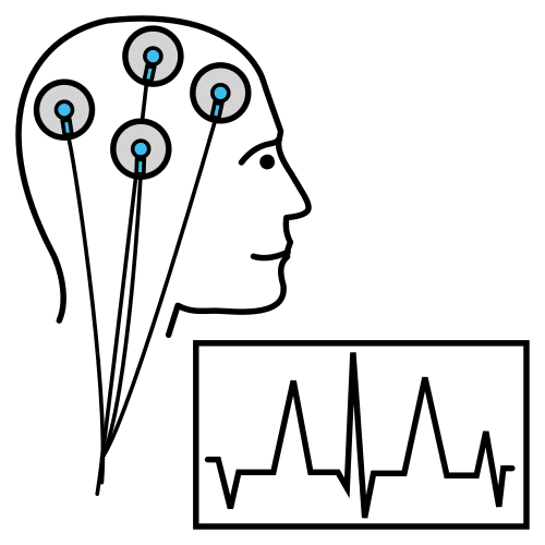 electroencephalogram