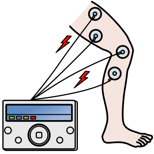 electrotherapy
