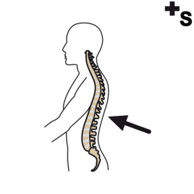 columnas vertebrales