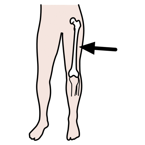 femur