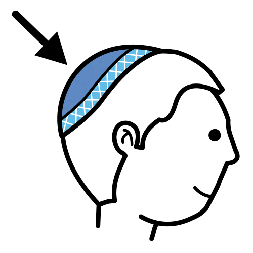 kippah