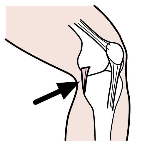 ligament