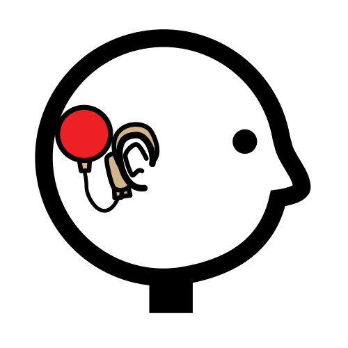 cochlear implant