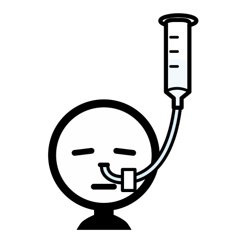 nasogastric intubation