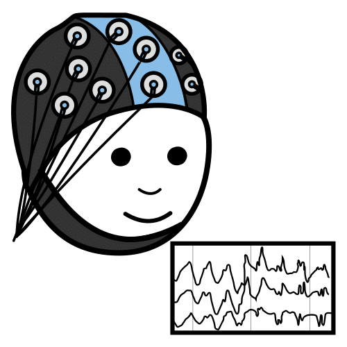electroencephalogram