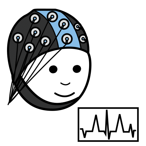 electroencephalogram