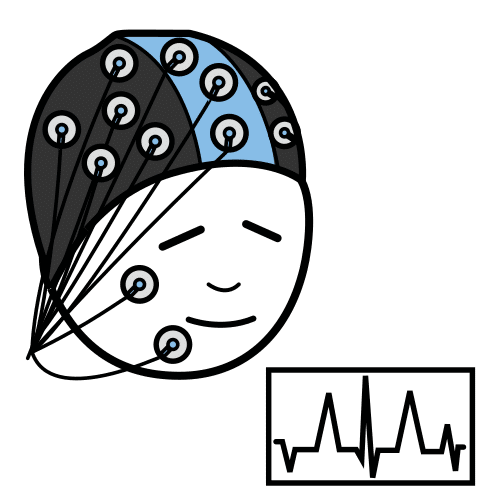 electroencephalogram