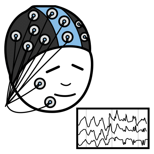 electroencephalogram