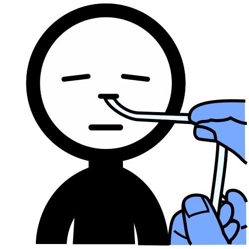 poner sonda nasogástrica