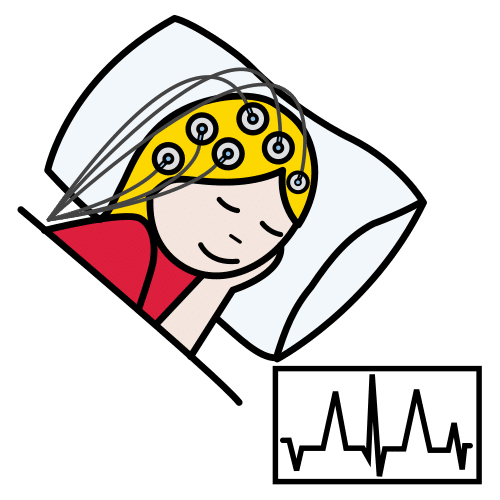 electroencephalogram