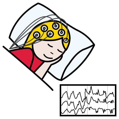 electroencephalogram