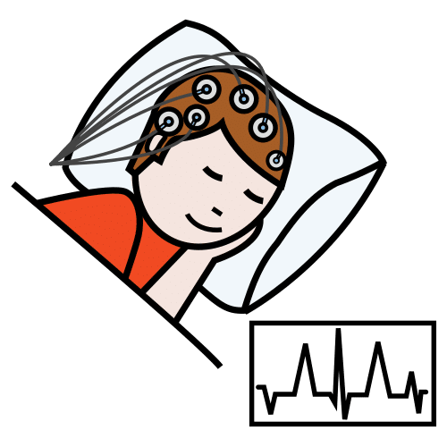 electroencephalogram