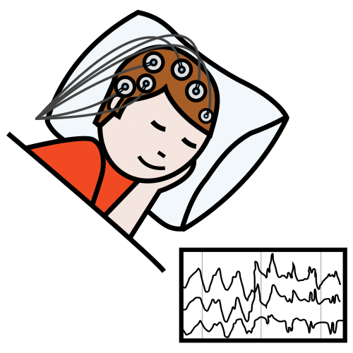electroencephalogram