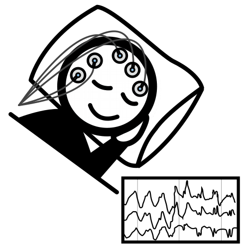 electroencephalogram
