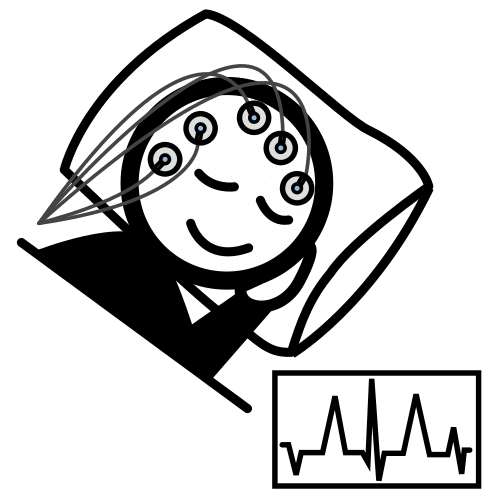 electroencephalogram