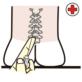 lumbar puncture