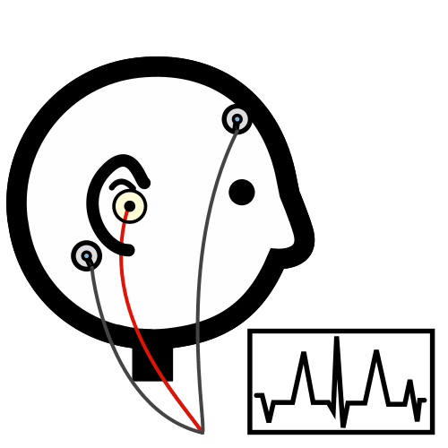 Evoked Potential-onderzoek