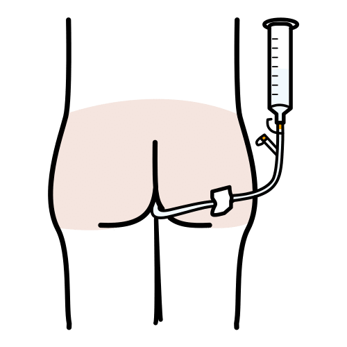 rectal catheter