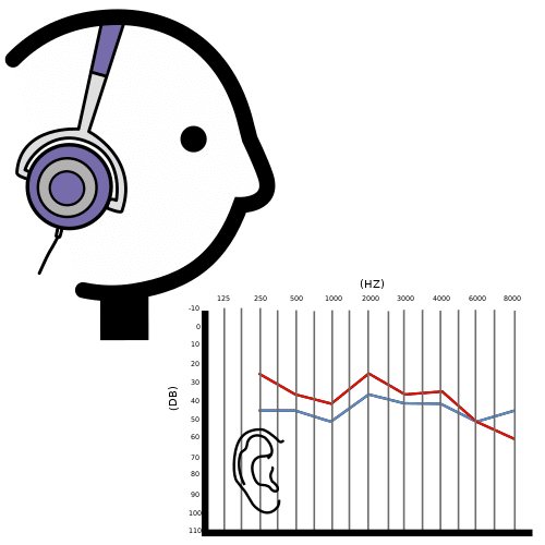 audiometrie