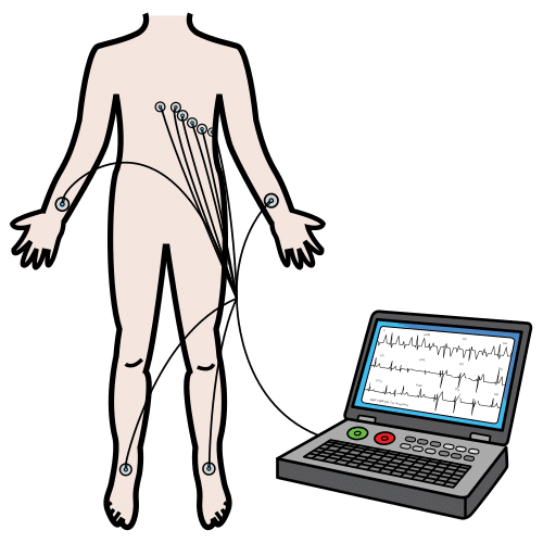 electrocardiogram