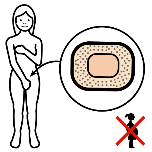 contraceptive patch