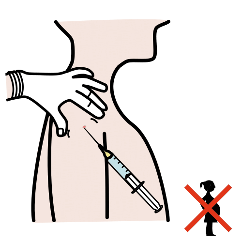 injectie van anticonceptie