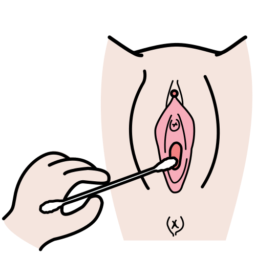 citologÃ­a vaginal