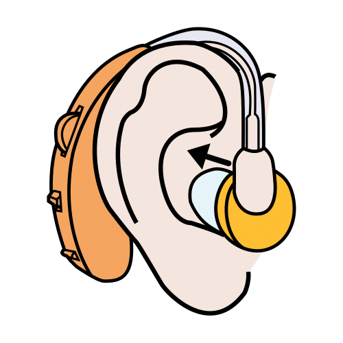 put on hearing aid