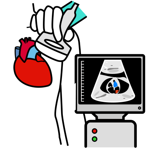 echocardiogram