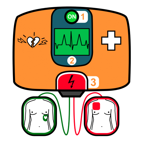 defibrillator