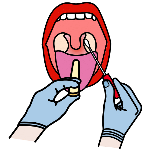 oropharyngeal swab test