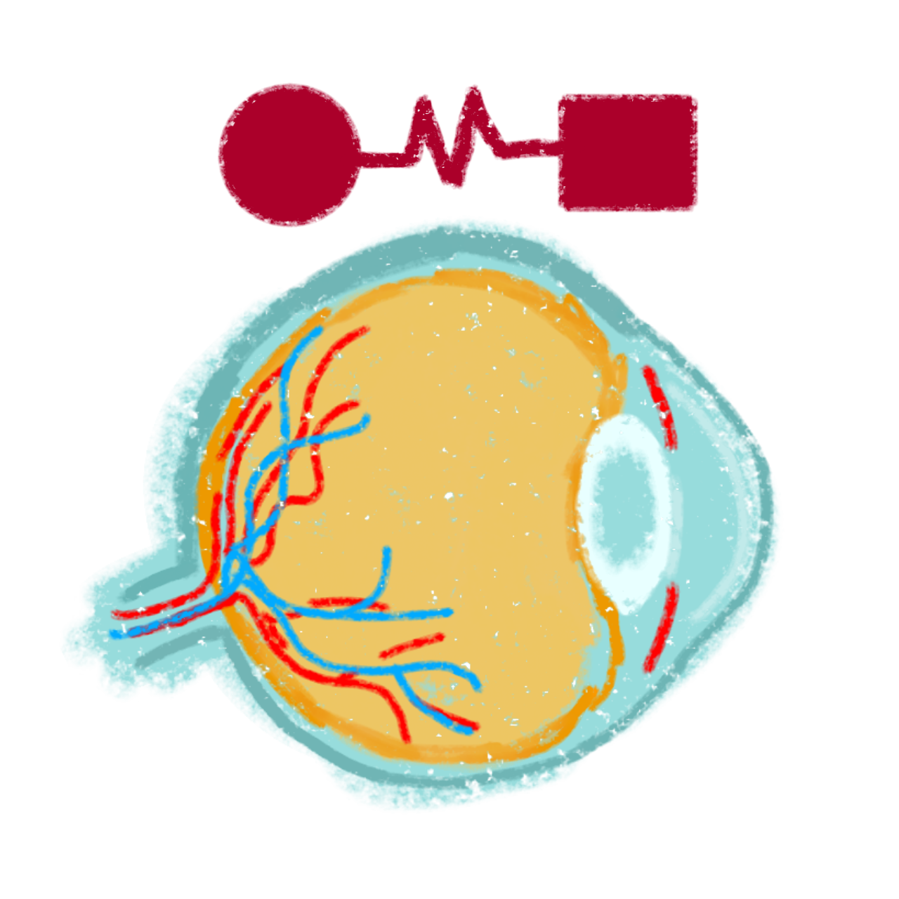 CVI (Cortical Visual Impairment)