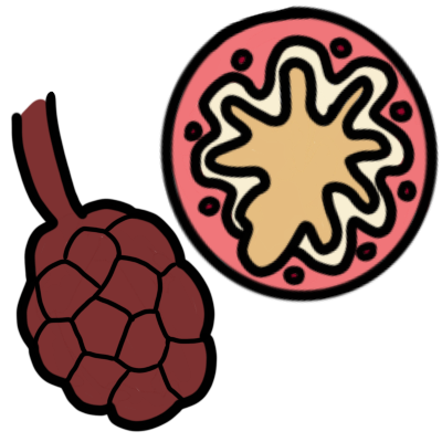 COPD (chronic obstructive pulmonary disease)