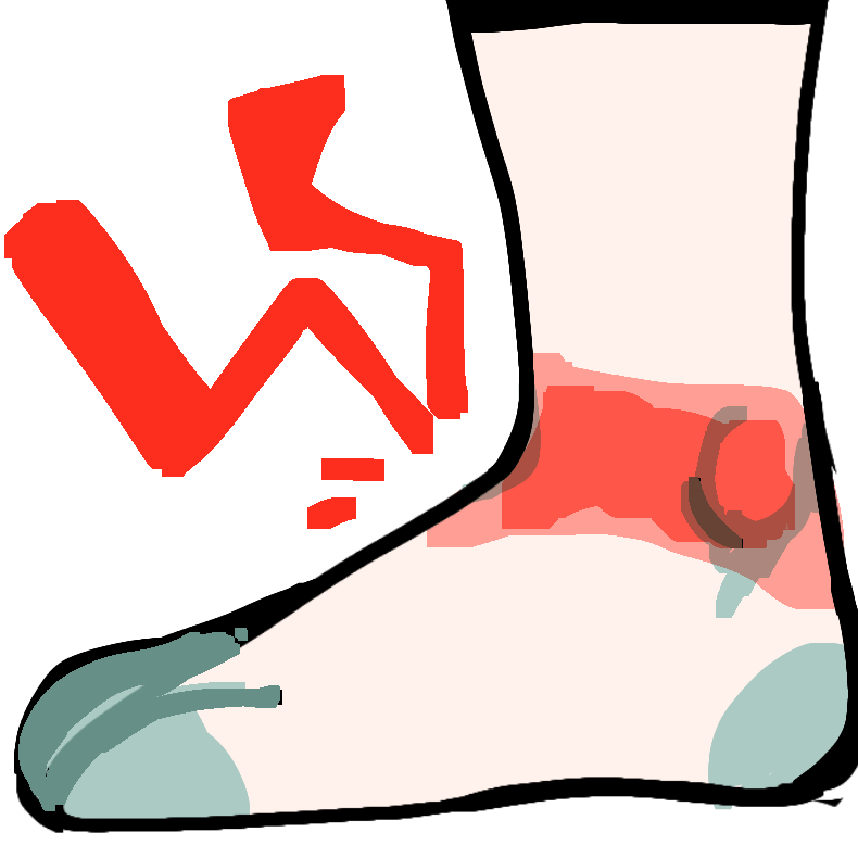 ankle pain