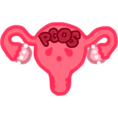 PCOS