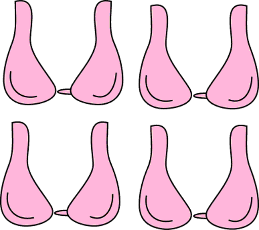 bras