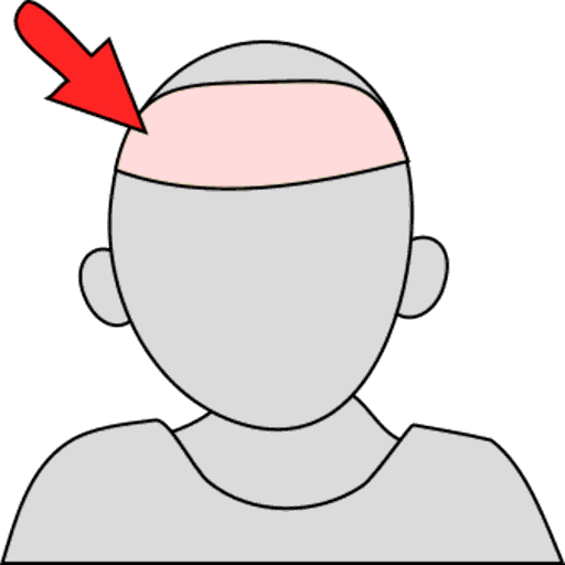 forehead
