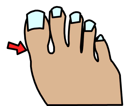 toe