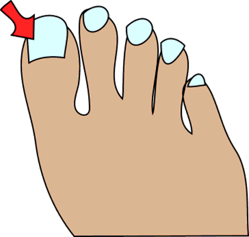 toenail
