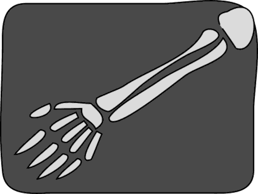 x ray