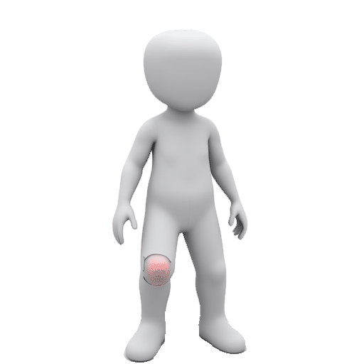 have sore knee