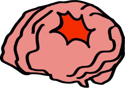 Traumatic Brain Injury / TBI